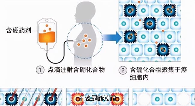 清零癌细胞仅需30分钟！中国抗癌硼药完成中试，费用约30万（组图） - 2