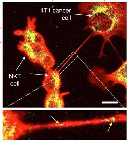 首次发现：癌细胞竟能“伸出大手”，掏走免疫细胞的线粒体（图） - 4