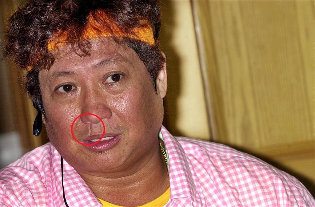 洪金宝脸上的疤痕，有香港资深记者爆料是黑道男星陈惠敏留下的。 (图/ 取自中时资料库，杨约翰摄)