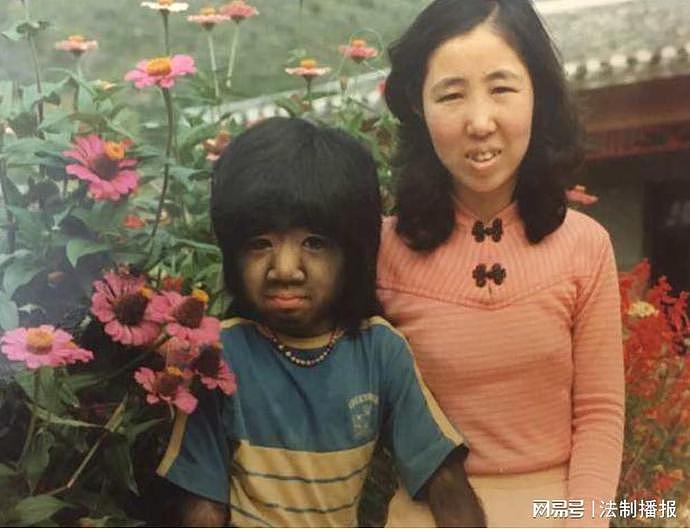 “中国第一毛孩”于震寰：42岁为娶娇妻被逼脱毛，如今儿子长成这样（组图） - 5