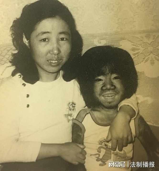 “中国第一毛孩”于震寰：42岁为娶娇妻被逼脱毛，如今儿子长成这样（组图） - 6