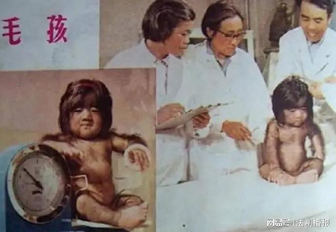 “中国第一毛孩”于震寰：42岁为娶娇妻被逼脱毛，如今儿子长成这样（组图） - 8