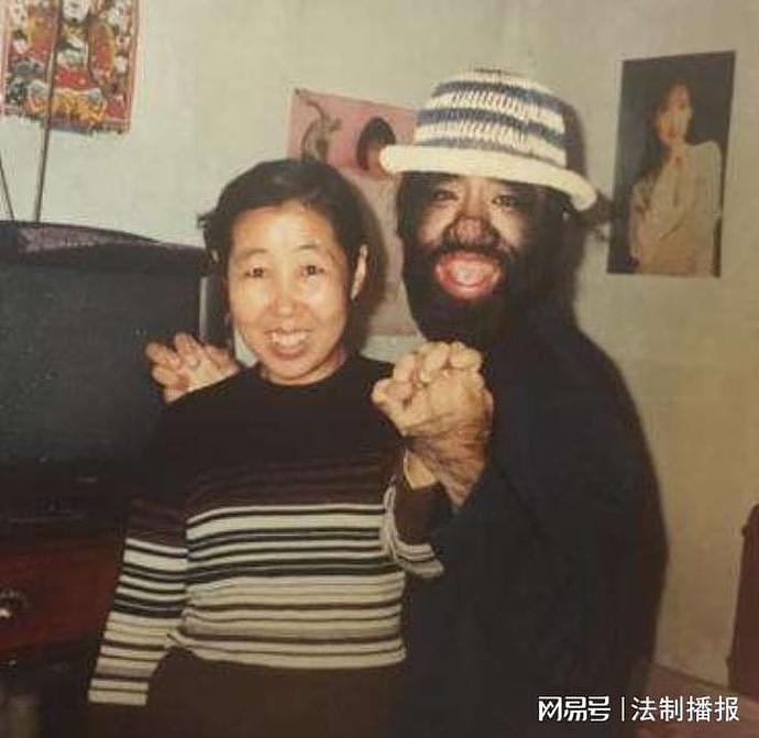 “中国第一毛孩”于震寰：42岁为娶娇妻被逼脱毛，如今儿子长成这样（组图） - 21