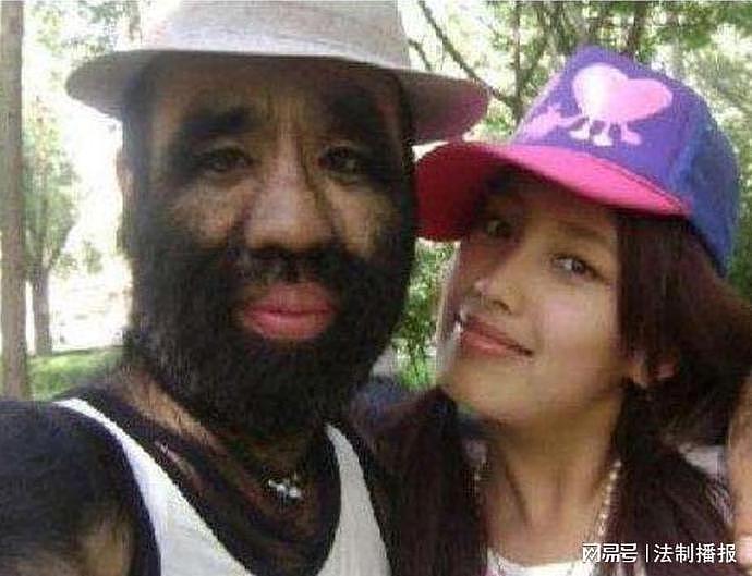 “中国第一毛孩”于震寰：42岁为娶娇妻被逼脱毛，如今儿子长成这样（组图） - 29