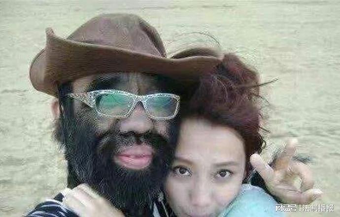 “中国第一毛孩”于震寰：42岁为娶娇妻被逼脱毛，如今儿子长成这样（组图） - 31