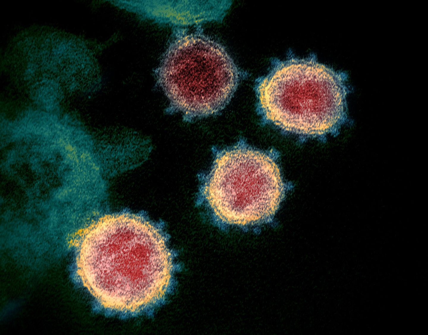 美国国家卫生研究院提供的一幅没标明日期的照片，照片中是电子显微镜下的新冠病毒SARS-Cov-2。（AP）