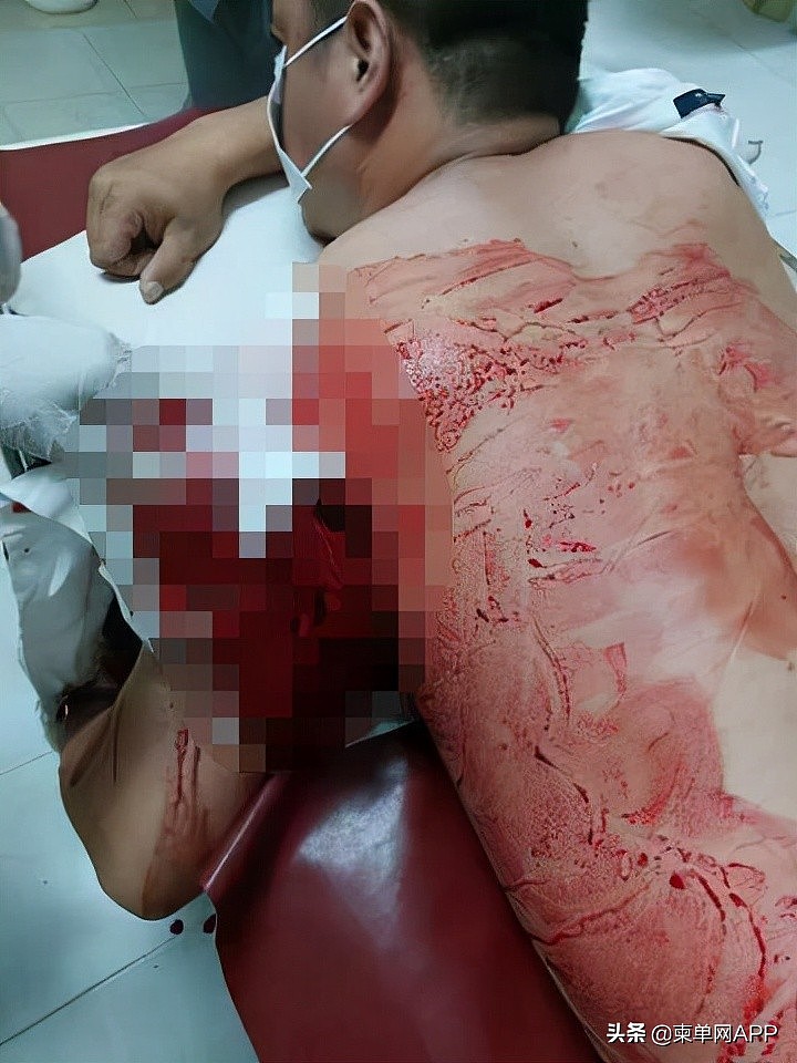 一柬埔寨中国籍男子将同胞砍成重伤