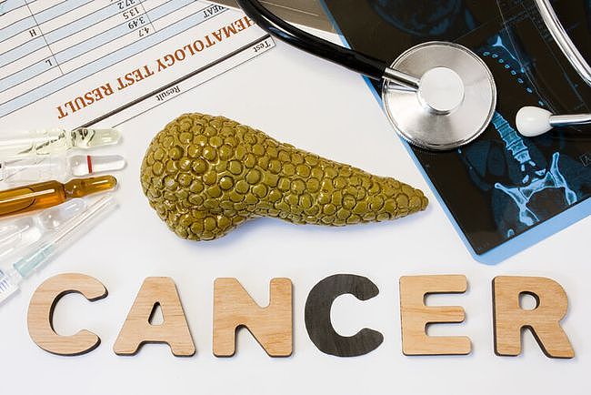 胰腺癌：从确诊到死亡不足5个月！这3个症状，都是它的敲门声（组图） - 3