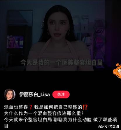 混血网红为当演员整容，直言把自己整残，整容前照片曝光颜值惊艳（组图） - 3