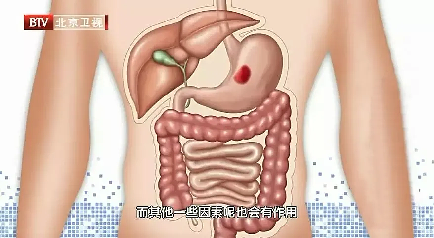 体检一有异常就是病了？5种体检“常见病”，基本不用治