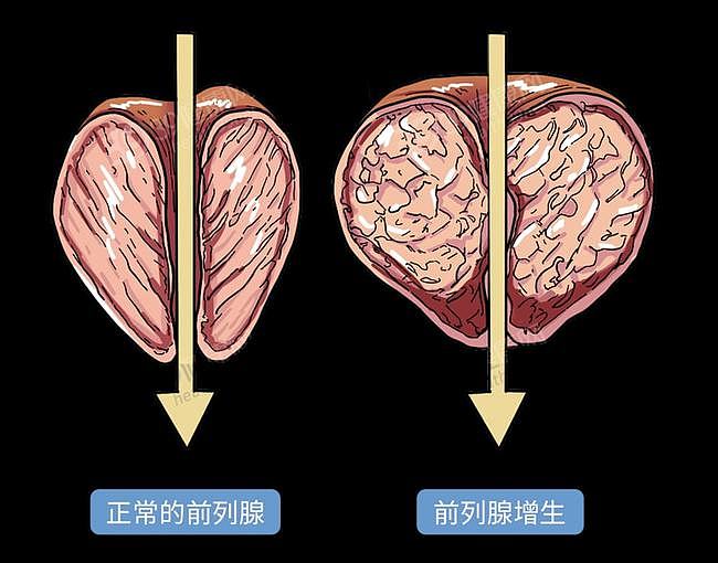 【健康】裤子脱了腿张开！医院里让人脸红的“男科检查”，一个比一个尴尬（组图） - 13