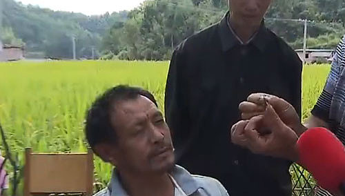 广东男子拔牙惊现1.5厘米长活蛆，真的有牙虫吗？它是哪里来的？