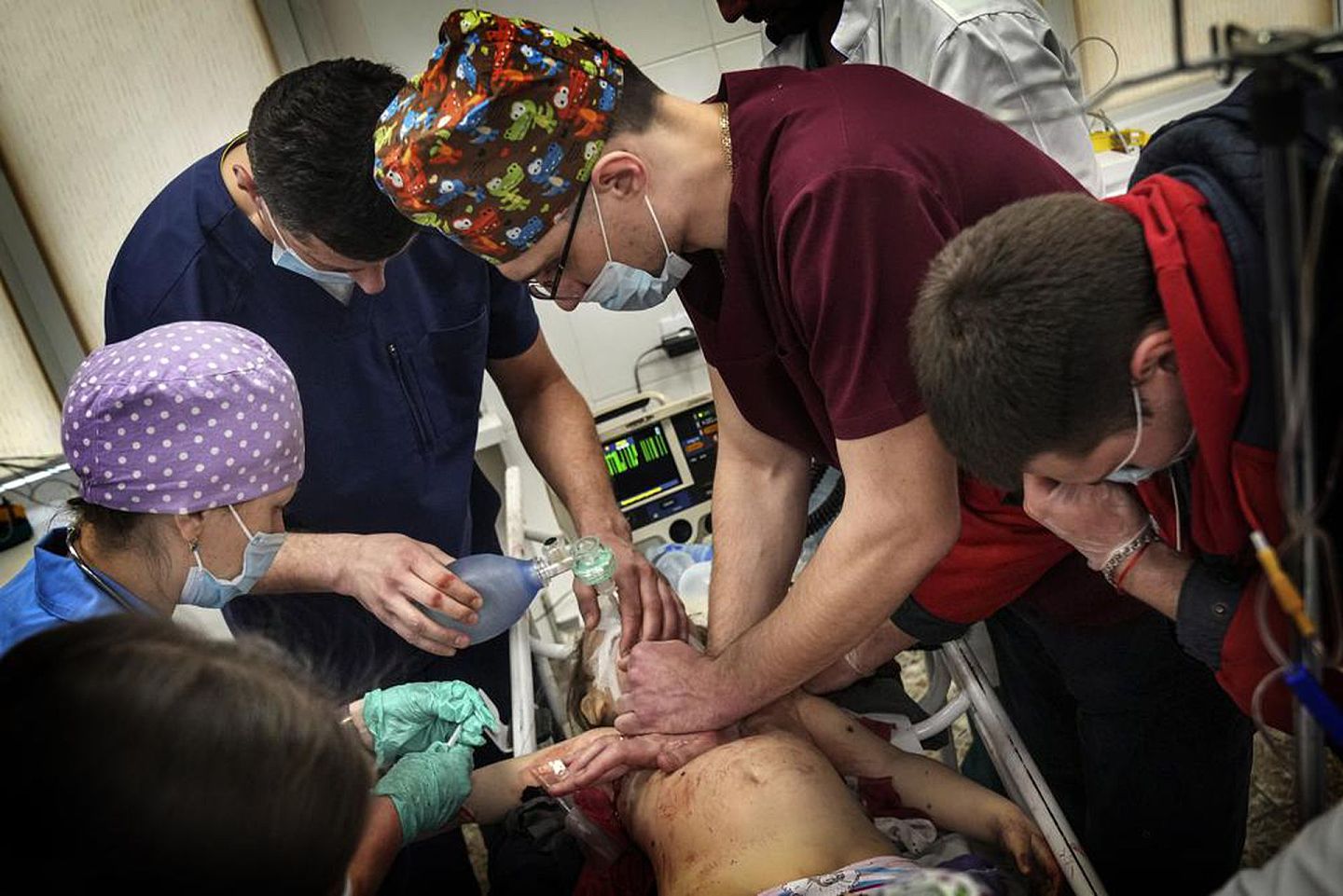 2022年2月27日，乌克兰东部马里乌波尔市医院，一名女孩在炮击中受伤，医护人员正在对她进行心肺复苏，女孩没能活下来。（美联社）