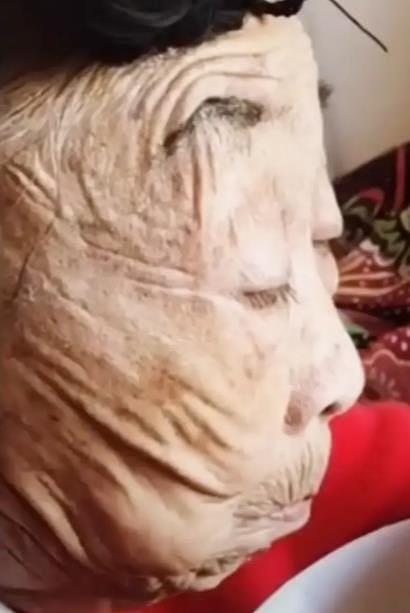 85岁马玉琴拉皮副作用明显，皮肤过度松弛，网友：以为是木雕（组图） - 1