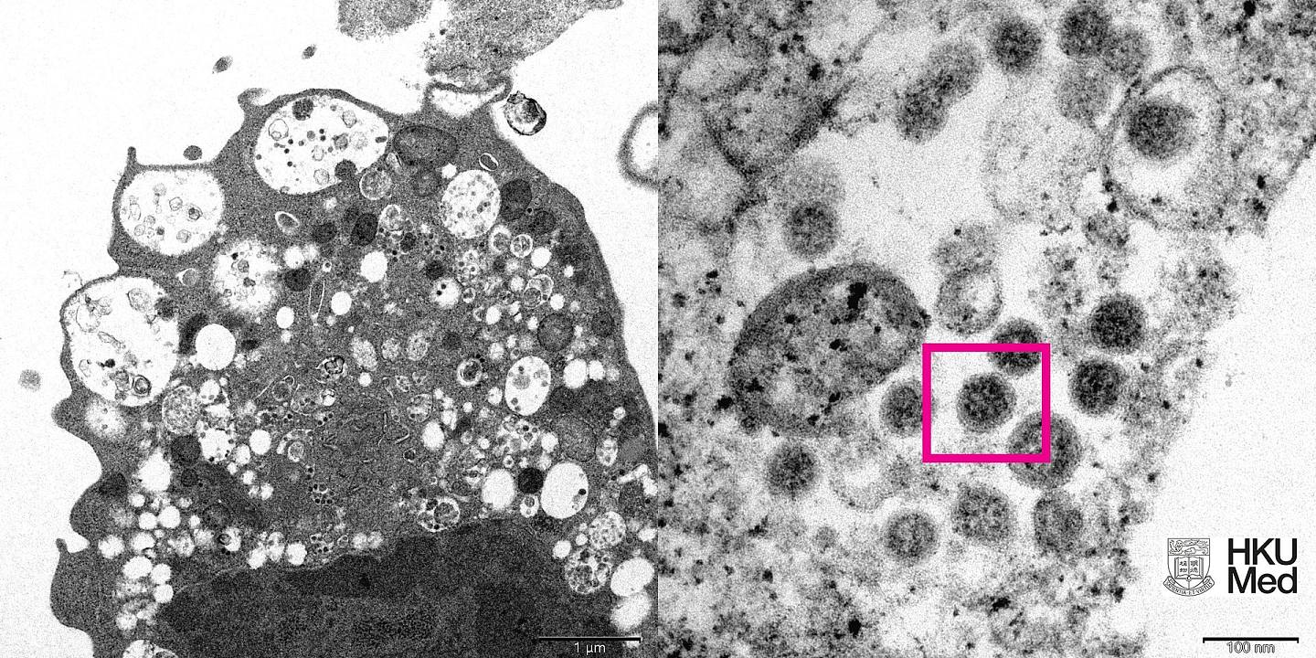 （图左）低倍电子显微镜下感染新型冠状病毒Omicron变异株后的猴肾细胞（Vero E6）。 照片显示细胞受损，肿胀囊泡，囊泡内含有黑色小病毒颗粒。 （图右）高倍电子显微镜下受感染的Vero E6细胞。 照片显示病毒颗粒，其表面呈现皇冠形的刺突蛋白（见红框）。 （香港大学医学院提供）
