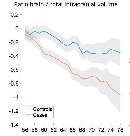 牛津大学研究：新冠病毒或加速大脑萎缩，相当于提前衰老1-10岁（组图） - 3