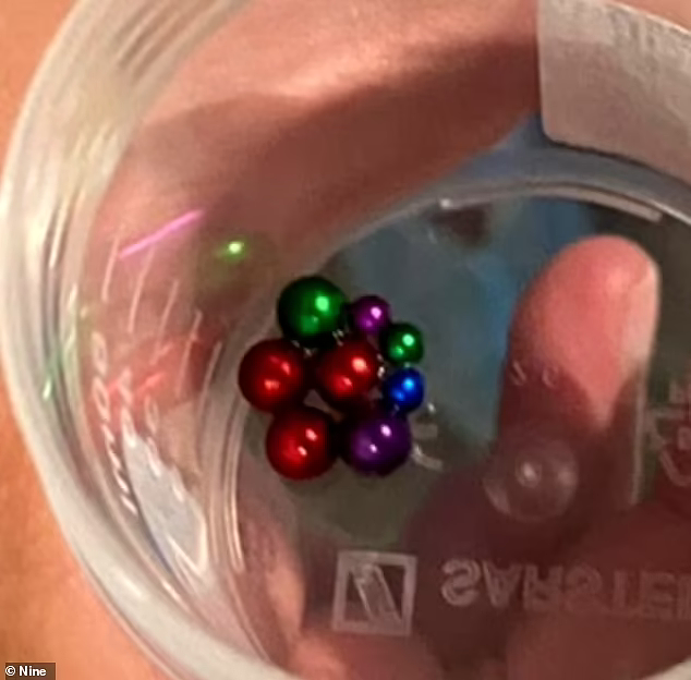 捏把汗！悉尼亚裔女童误吞8颗磁铁球，幸及时送医手术（视频/组图） - 3