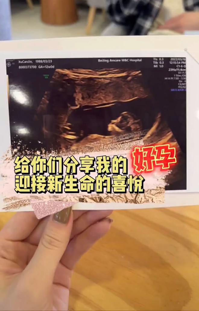 高晓松34岁前妻官宣怀二胎！嫁帅哥再婚不到1年，大女儿已经14岁（组图） - 5