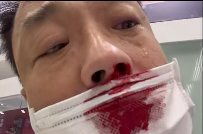 TVB前男星王喜入境台湾被捅伤，满脸鲜血，发文缉凶：立即向我自首（组图） - 3