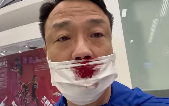 TVB前男星王喜入境台湾被捅伤，满脸鲜血，发文缉凶：立即向我自首（组图） - 2