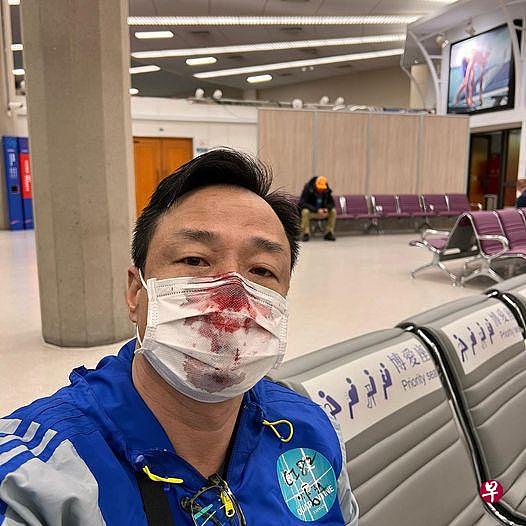 香港男星王喜昨天在社媒公开在台湾桃园机场接受PCR检测时被戳出鼻血。（取自王喜面簿）