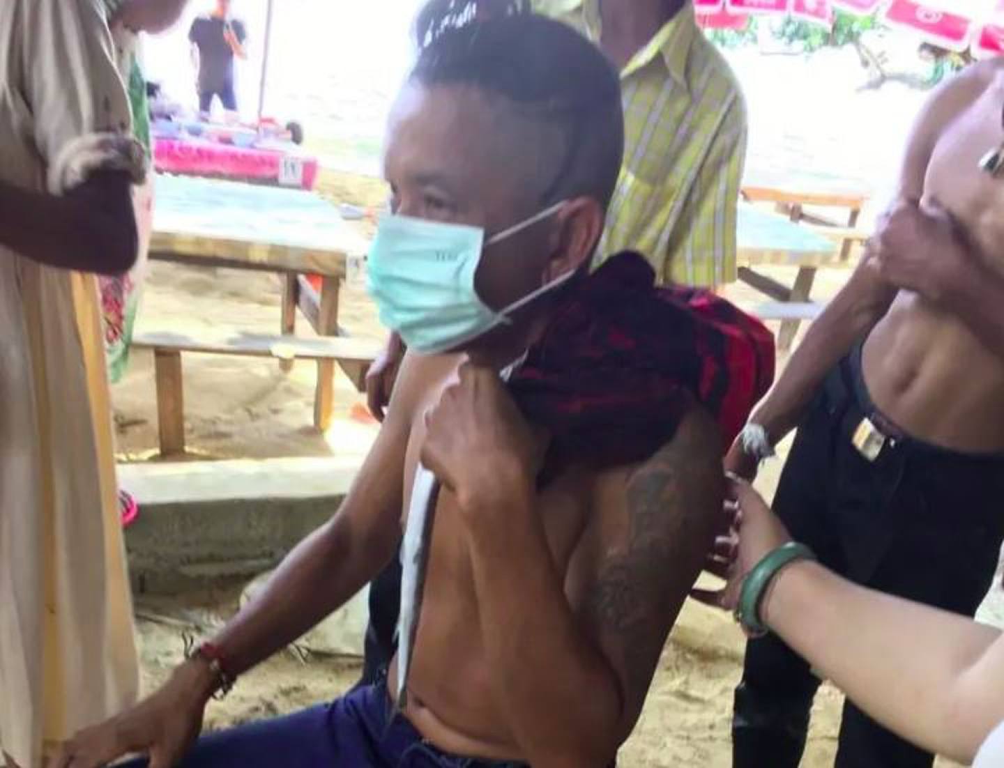 泰国一名男在沙滩游泳时，突然被一条尖嘴怪鱼袭击刺穿颈部大量出血。 （网上图片）