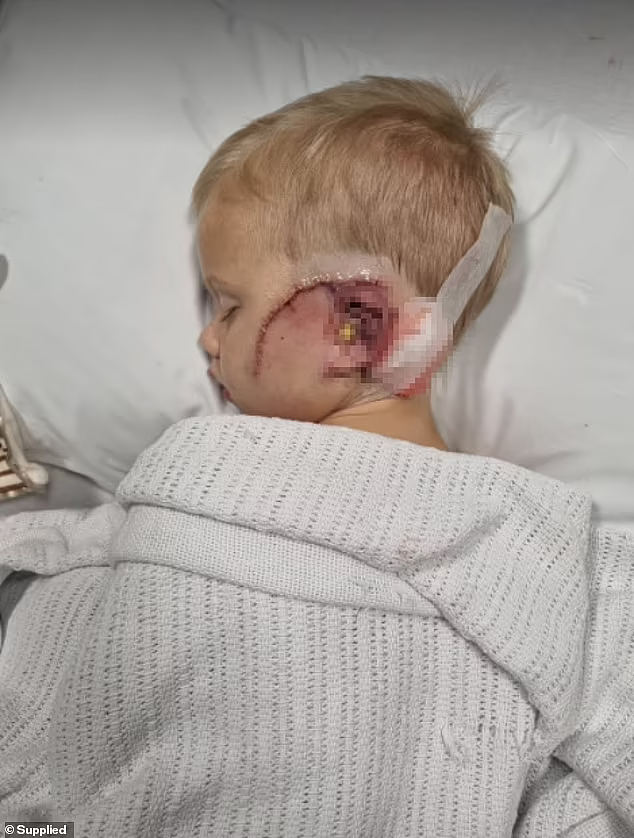 揪心！澳4岁男童被狗咬伤，“满头鲜血”走向父母，左脸留下巨大伤疤（组图） - 2