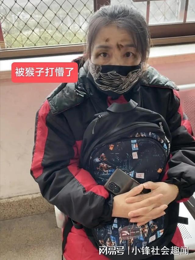 女子和猴子发生争执，打得满脸是伤，被留在景区办公室，动物没被抓，仍然“逍遥法外”（组图） - 5