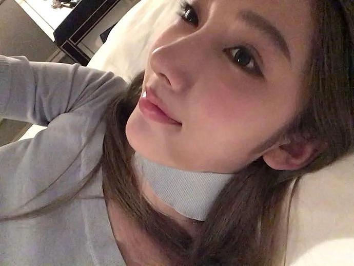 都美竹大方承认整容后，业内博主评价：把19岁的脸整成了39岁（组图） - 3