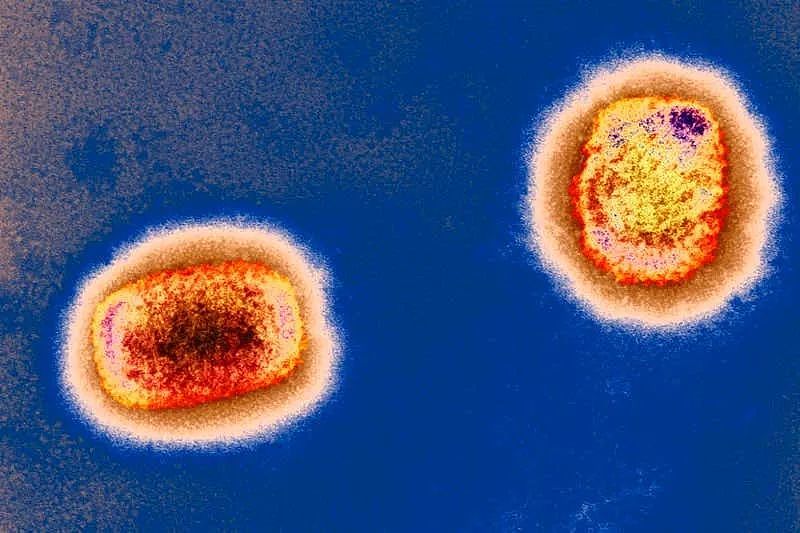 多国出现猴痘病例，会成为另一个大规模传染病吗？（图） - 1