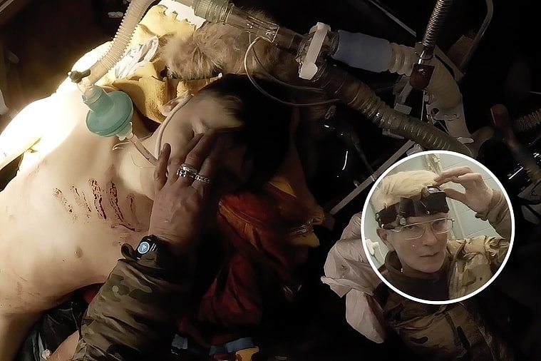 塔伊拉(小图)用头上的摄影机拍下乌克兰军医的日常，医疗团队无法救回受伤的男童，她轻轻将男童眼皮阖上。 美联社
