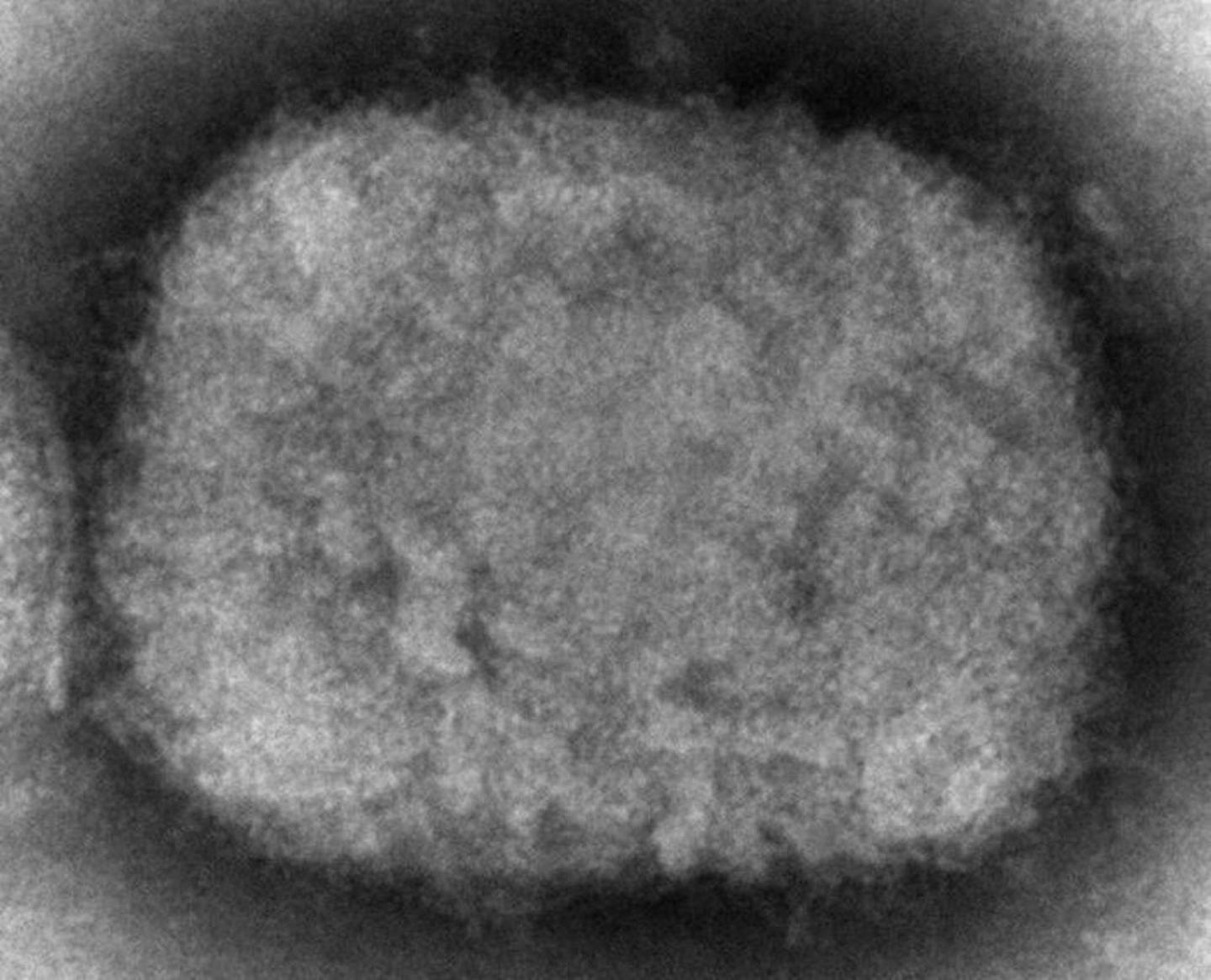 图为2003年，一个电子显微镜下，猴痘病毒的形态。 （AP）