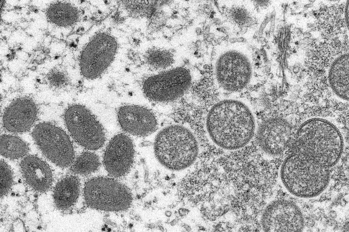 图为2003年，电子显微镜下拍摄猴痘病毒的颗粒。 （AP）