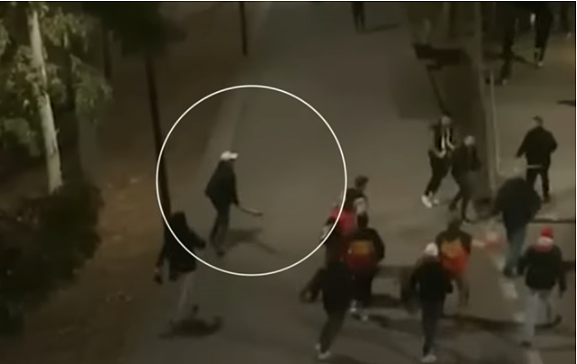 澳内城区街头发生暴力事件，2人持械殴打1人，致其颅骨骨折，眼肿如高尔夫球（视频/组图） - 2
