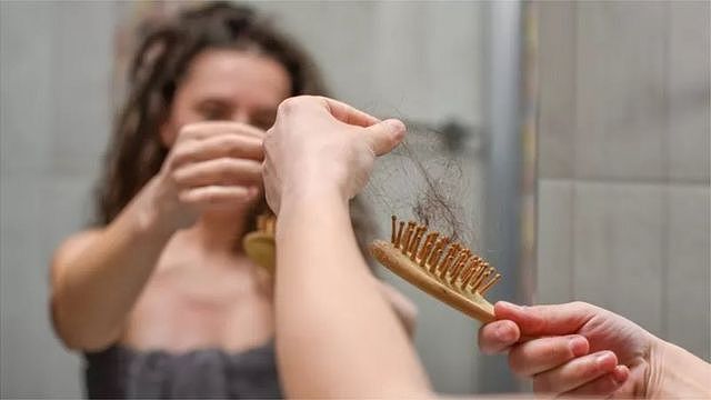 hairloss