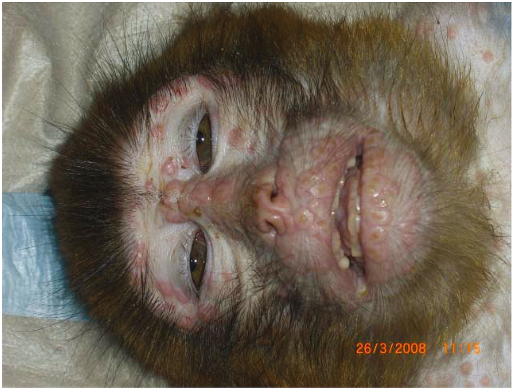 猴痘如何流行？中国如何应对？人类猴痘专家最权威解读（组图） - 5