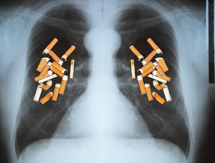 【健康】美国研究：抽烟越多，或不易患肺癌？烟能放心吸吗？真相来了（组图） - 4