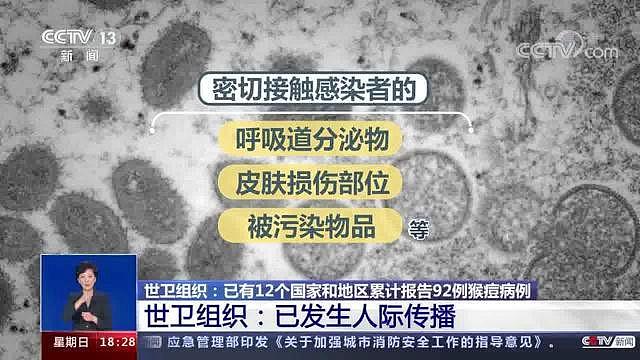 猴痘会传入中国吗？40岁以下国人普遍对其无免疫力（图） - 3
