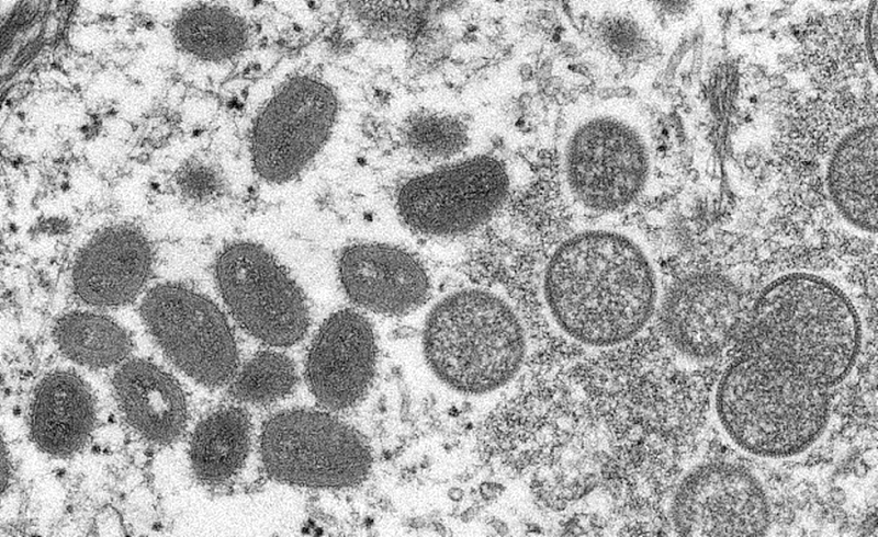 美国官员23日表示，美国正准备对猴痘确诊者的密切接触者提供疫苗。 图为猴痘病毒粒子。 （图取自美国疾管署网页cdc.gov）