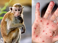“史无前例”猴痘疫情爆发！这两种人群高危，恐成永久地方流行病？疫苗曝重大副作用（组图）