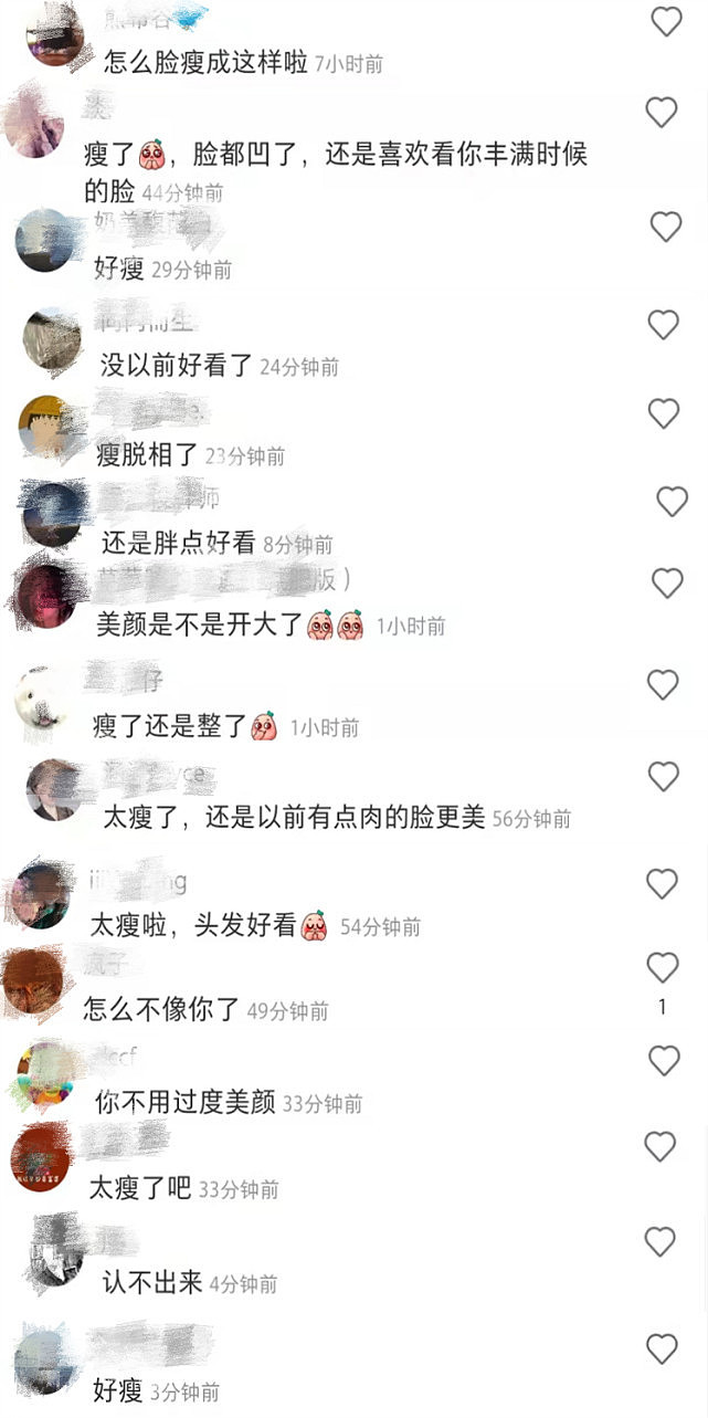 张雨绮脸颊凹陷瘦脱相被质疑整容，网友直呼“没以前好看”（组图） - 6