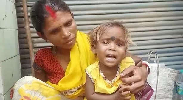 “蜘蛛女孩”多了两条胳膊两条腿，来自印度，家人担忧手术费