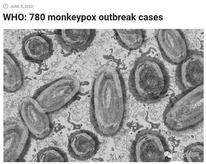 纽约已确诊5例！WHO称猴痘已在华人最多社区中传播，遏制恐太晚（图） - 1