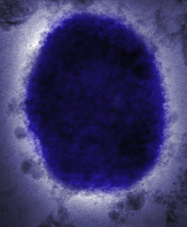 Monkeypox virus particle