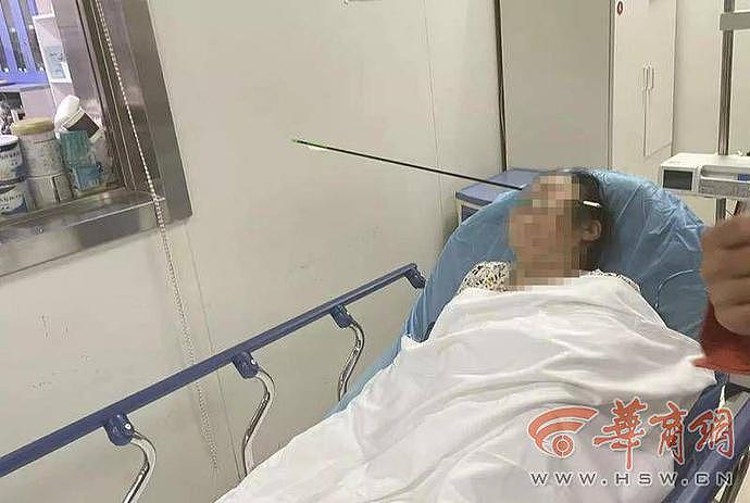 中国一男子在小区玩弓箭射中散步的女士，警方已介入调查（图） - 1