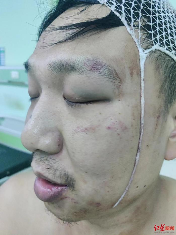 四川内江烧烤店打架事件：有人称肋骨被打断，警方通报称因抢客源引发（视频/组图） - 2