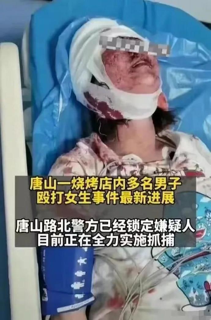 唐山打人案另一女孩伤情照片曝光！右眼疑被打爆，更痛心在后面，网友：多处骨头估计全碎了（视频/组图） - 12