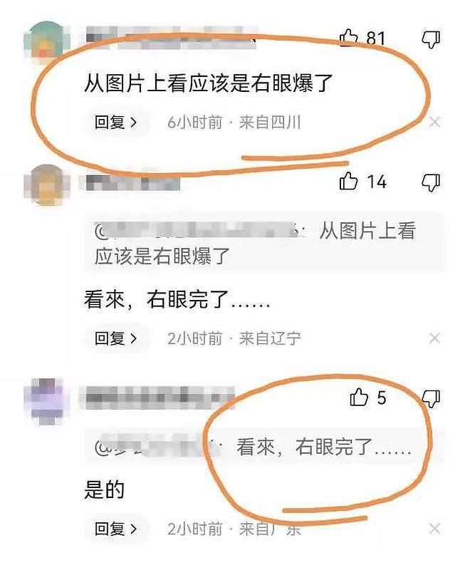 唐山事件女孩眼睛疑似被打爆！7大疑点细思极恐，央视强硬表明态度：把保护伞打掉（视频/组图） - 4