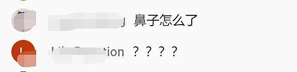 42岁萧亚轩空降金曲奖现场，被狗咬伤后首次亮相，用浓妆遮掩伤疤（组图） - 10