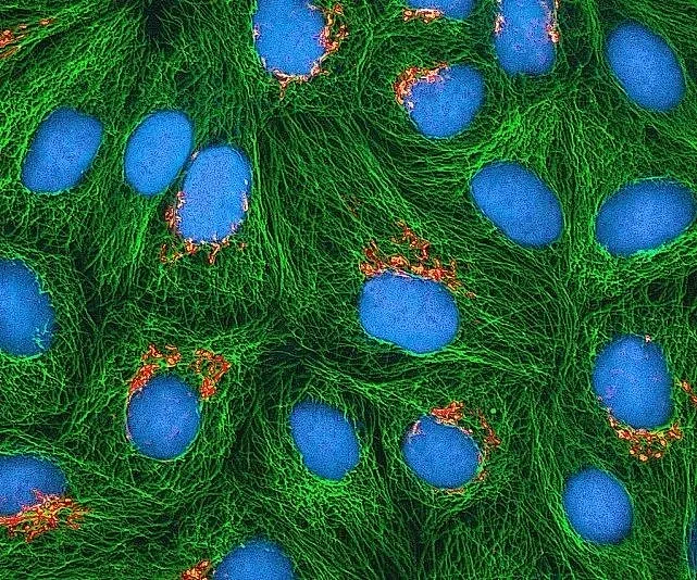 图：培养的海拉细胞